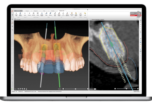 CBCT Scan Images