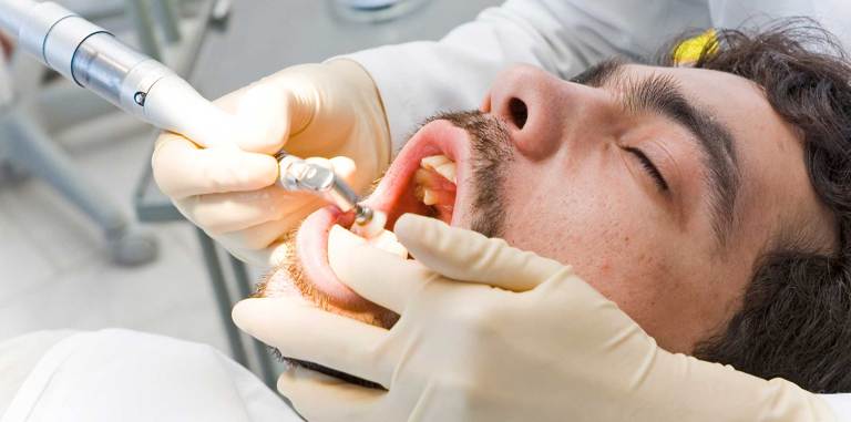 adult male laying in a dental chair with his mouth open for a dental polishing